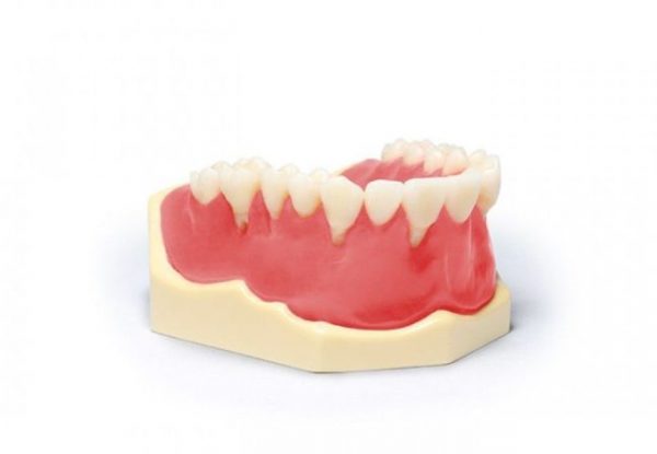 zubnie-protezi-prisoskax-E9F9F2B